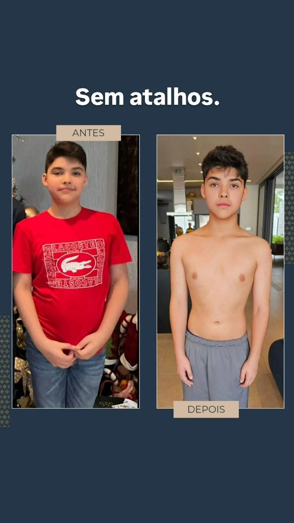 Resultado Antes e Depois Léo Personal